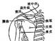 肩周炎的艾灸疗法