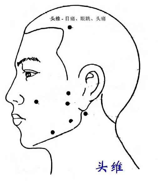 头部侧面穴位图