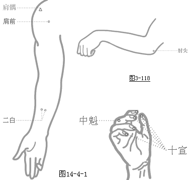 奇穴图-肩前