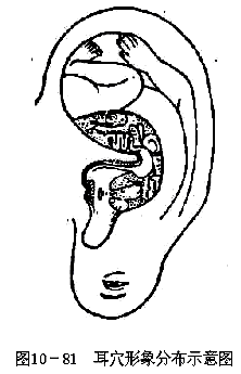耳穴形象分布示意图