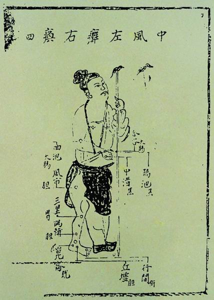 《针灸问答》