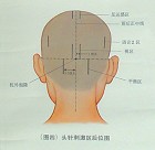 头针刺激区4 